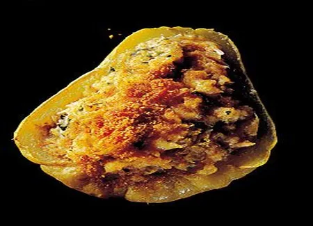 Pommes de terres gratinées au crabe